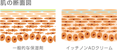 肌の断面図